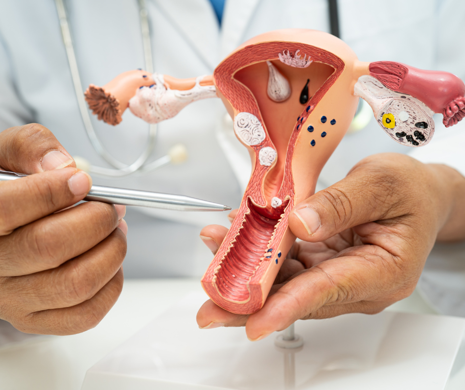 PREVENCIÓN Y TRATAMIENTO GINECOLÓGICOS EN CANCÚN